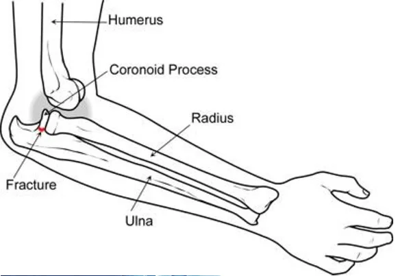 Arm