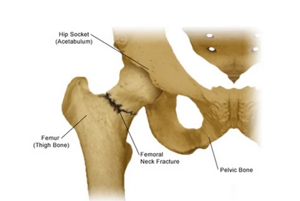 Hip