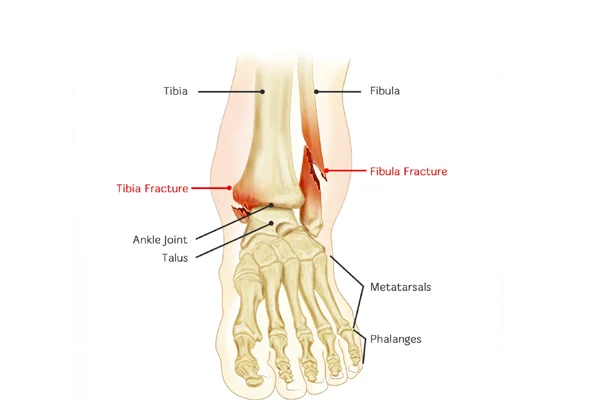 Tibia