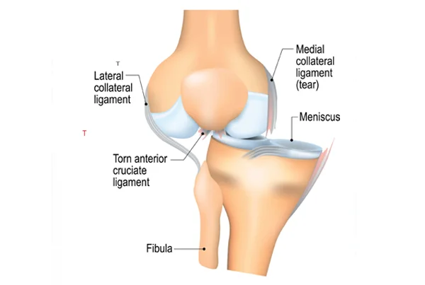 Knee