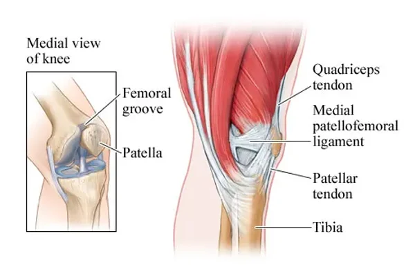 MCL / MPFL Injury