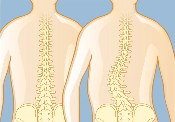 Deformity Correction