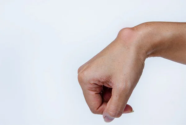 Ganglion